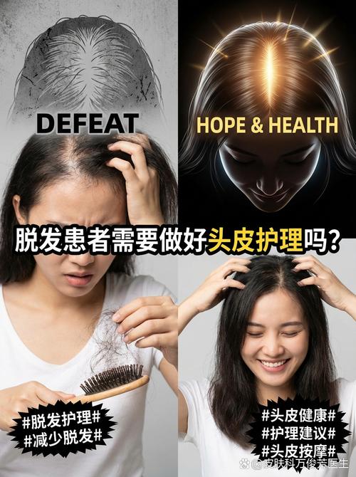 脱发患者需要做好头皮护理
